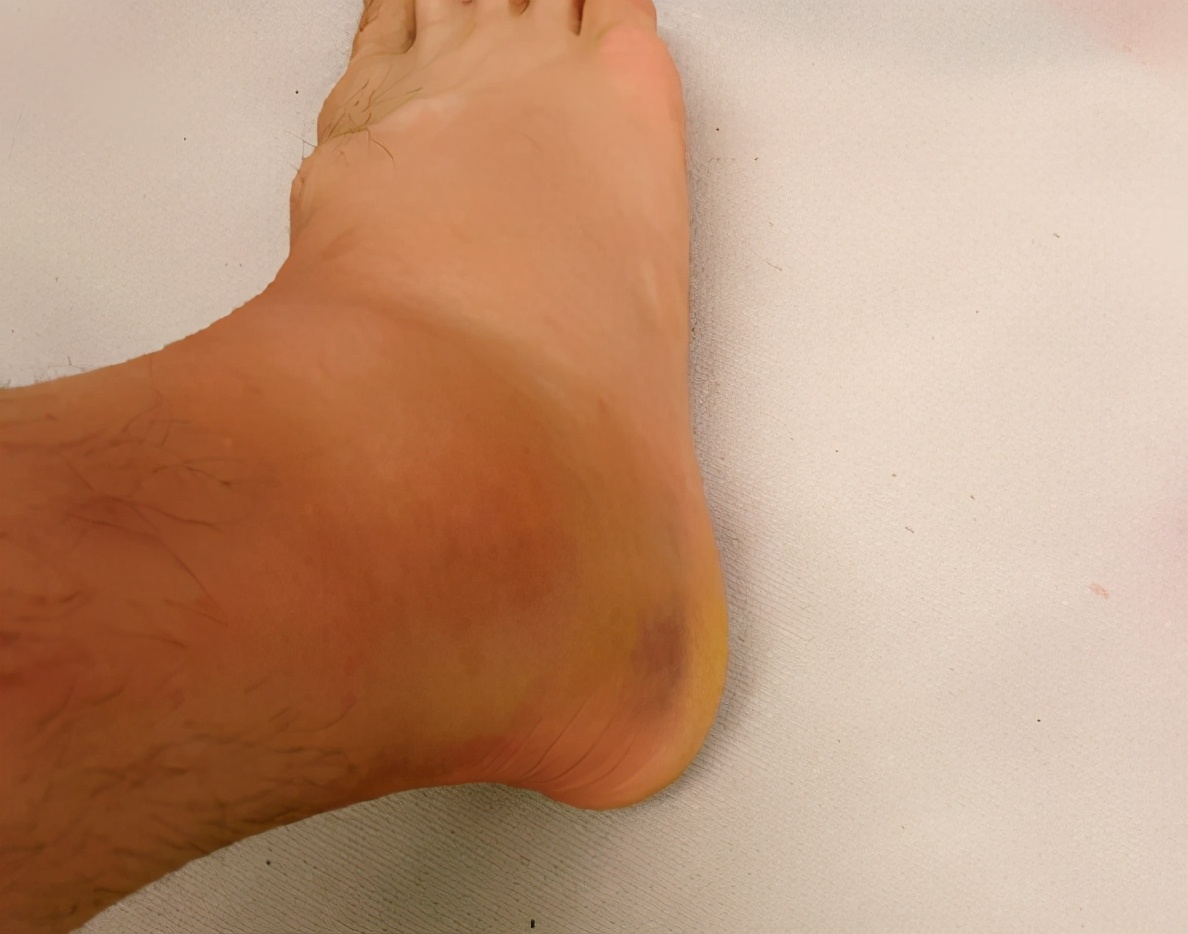 广东男篮将战辽宁男篮周琦复出吗,男篮周鹏回归完整版