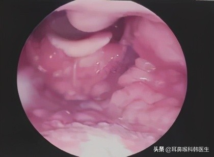 为啥来院就做内镜检查?医生怕是在骗我钱吧