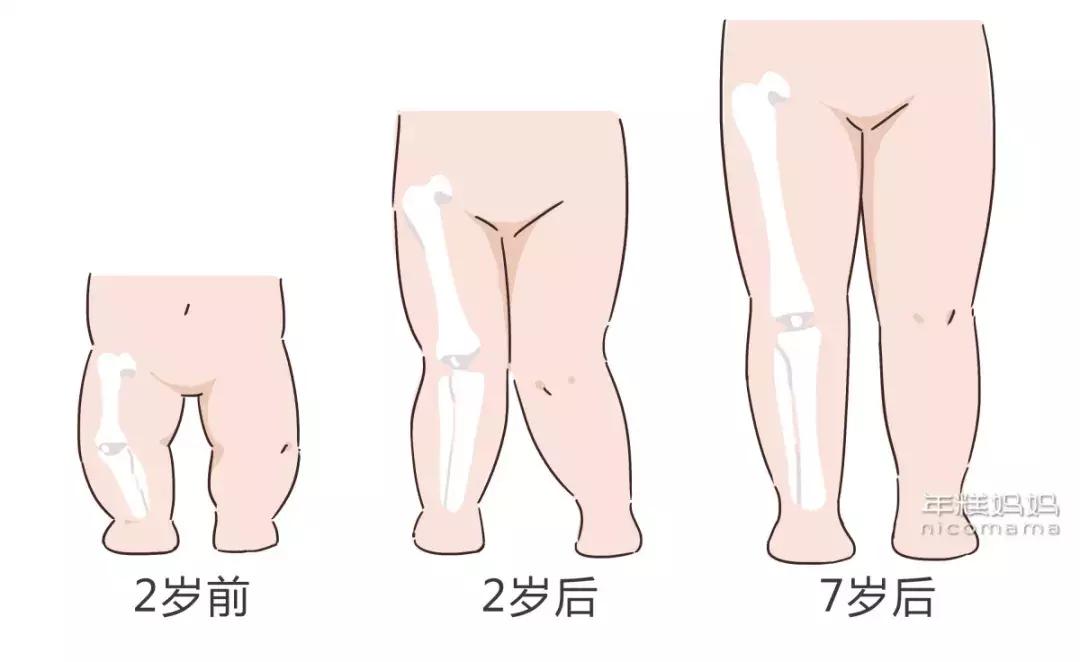 别给孩子穿这三类鞋,千万不要给孩子穿这四种鞋