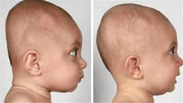 睡枕头和不睡枕头的娃,小孩是睡枕头好还是不睡枕头好