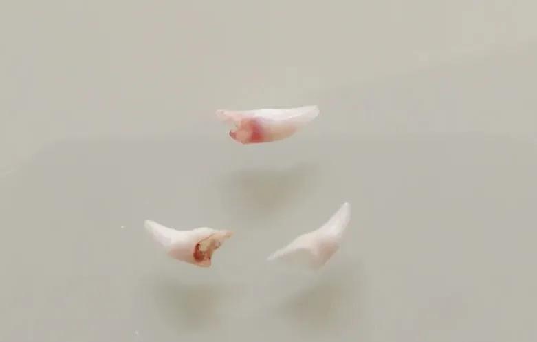 猫咪蛀牙可以洗掉吗,猫咪牙齿蛀牙怎么办