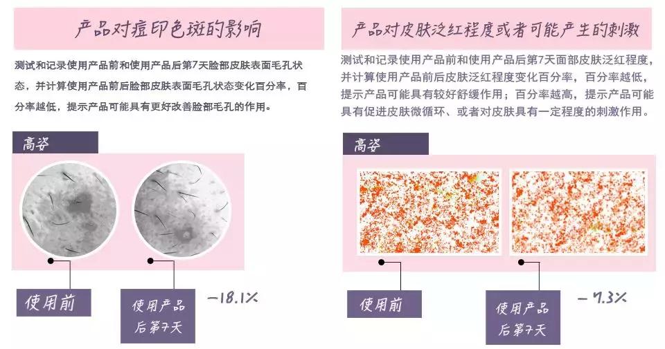 美白祛斑精华国货,国货美白vc精华