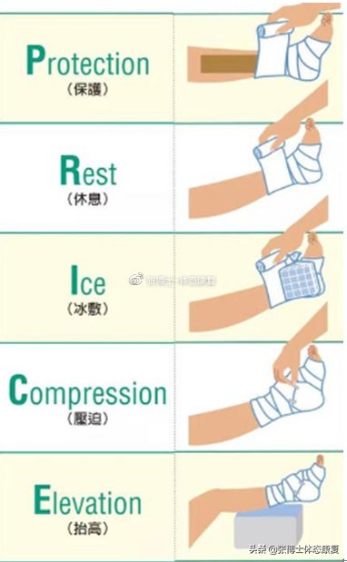 运动康复中的smart原则,运动损伤与运动康复pdf