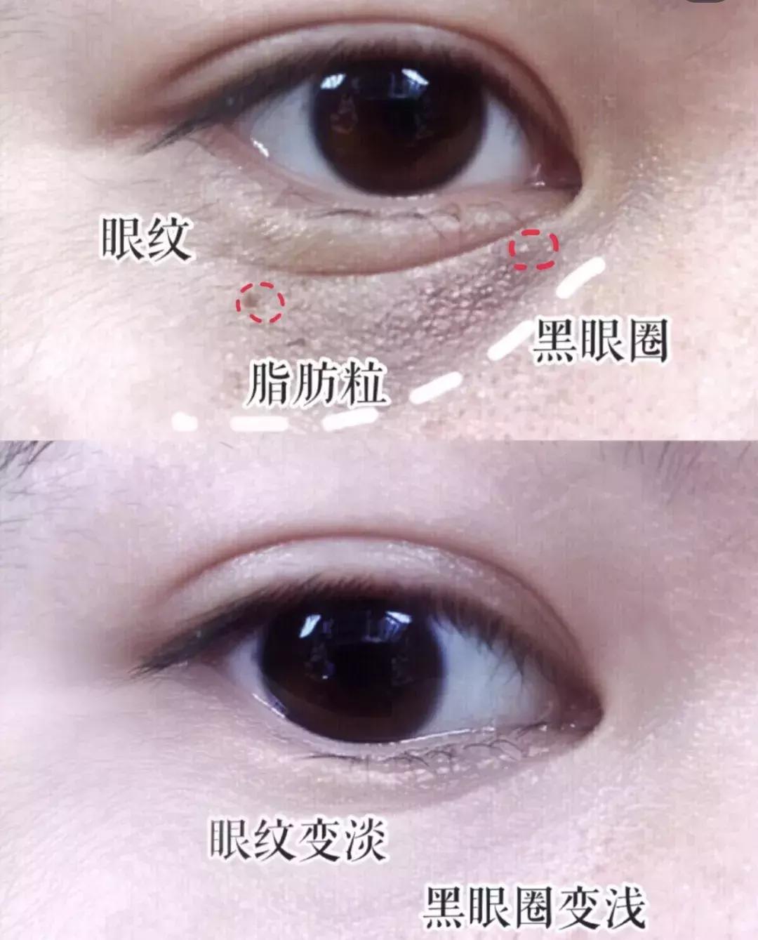 有了前法国第一夫人的百元“黑科技”眼霜,我把3000块眼霜扔了!