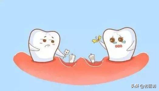 塞牙代表牙坏了吗,牙齿长期塞牙会蛀牙吗