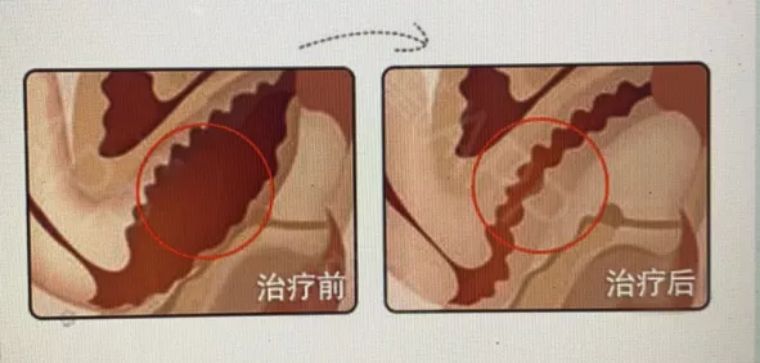 比奥特曼还强的怪兽,比奥特曼还强的三只怪兽