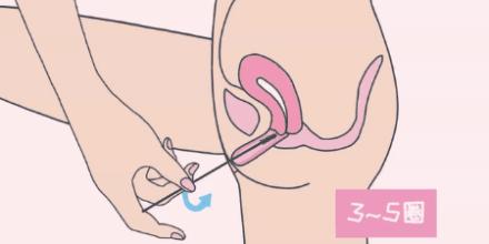 HPV病毒会不会从低危型升级为高危型？