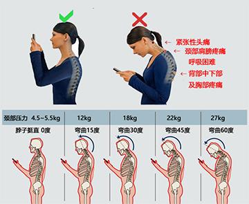如何改善脖子向前倾,怎么改善脖子前后倾