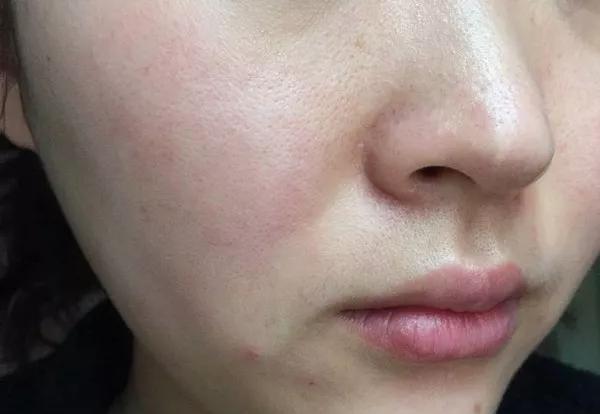 火山泥真是宝,油皮女孩的毛孔疏通剂,让贵妇霜3秒吃透锁水8倍