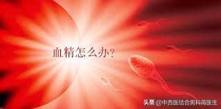 精液发黄一定是有疾病吗？看完这6个原因你心里就有数了