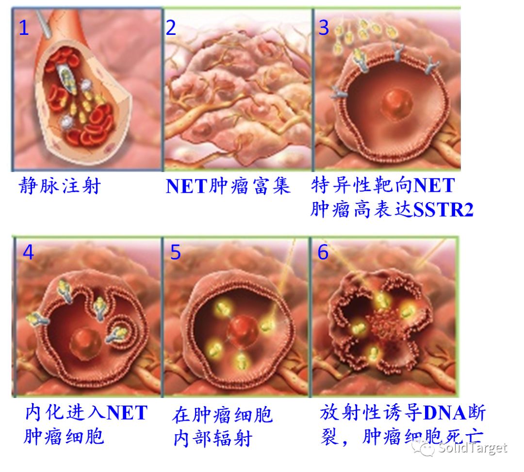 治癌症的最新突破,癌症最新技术突破是什么