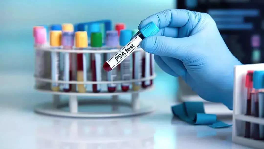 psa不高可能是癌症吗,psa升高代表疾病进展吗