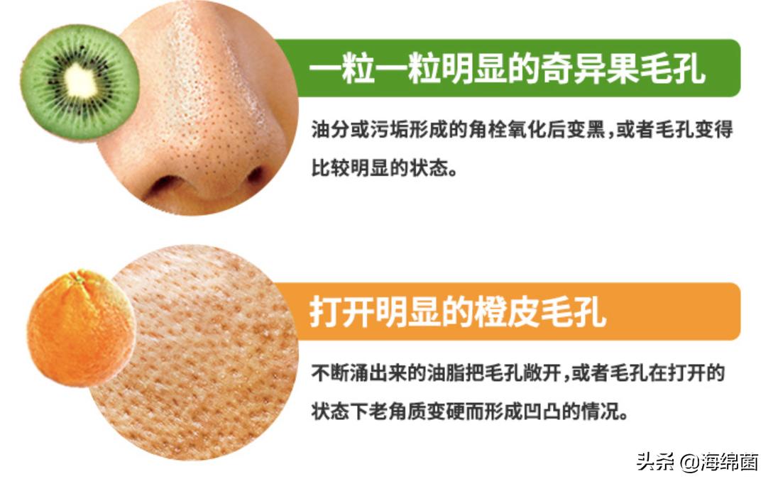 中年油腻男如何控油,男生冬天控油保湿步骤