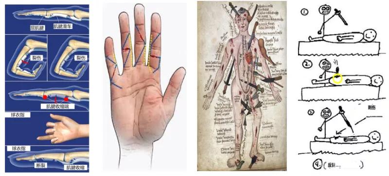 临床清创原则,临床清创