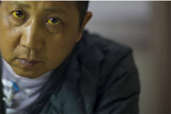 如何看懂肝功能化验单？医生手把手告诉你，一看就懂