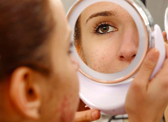 一周裸脸修复之后怎么用护肤品,瑕疵脸如何护肤修复