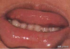 最实用的舌诊图六大舌象,舌诊深入学习书