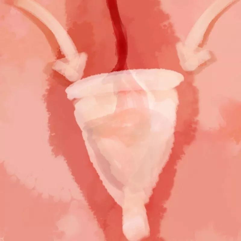 夜光杯和卫生巾哪个好,卫生巾和月亮杯利弊