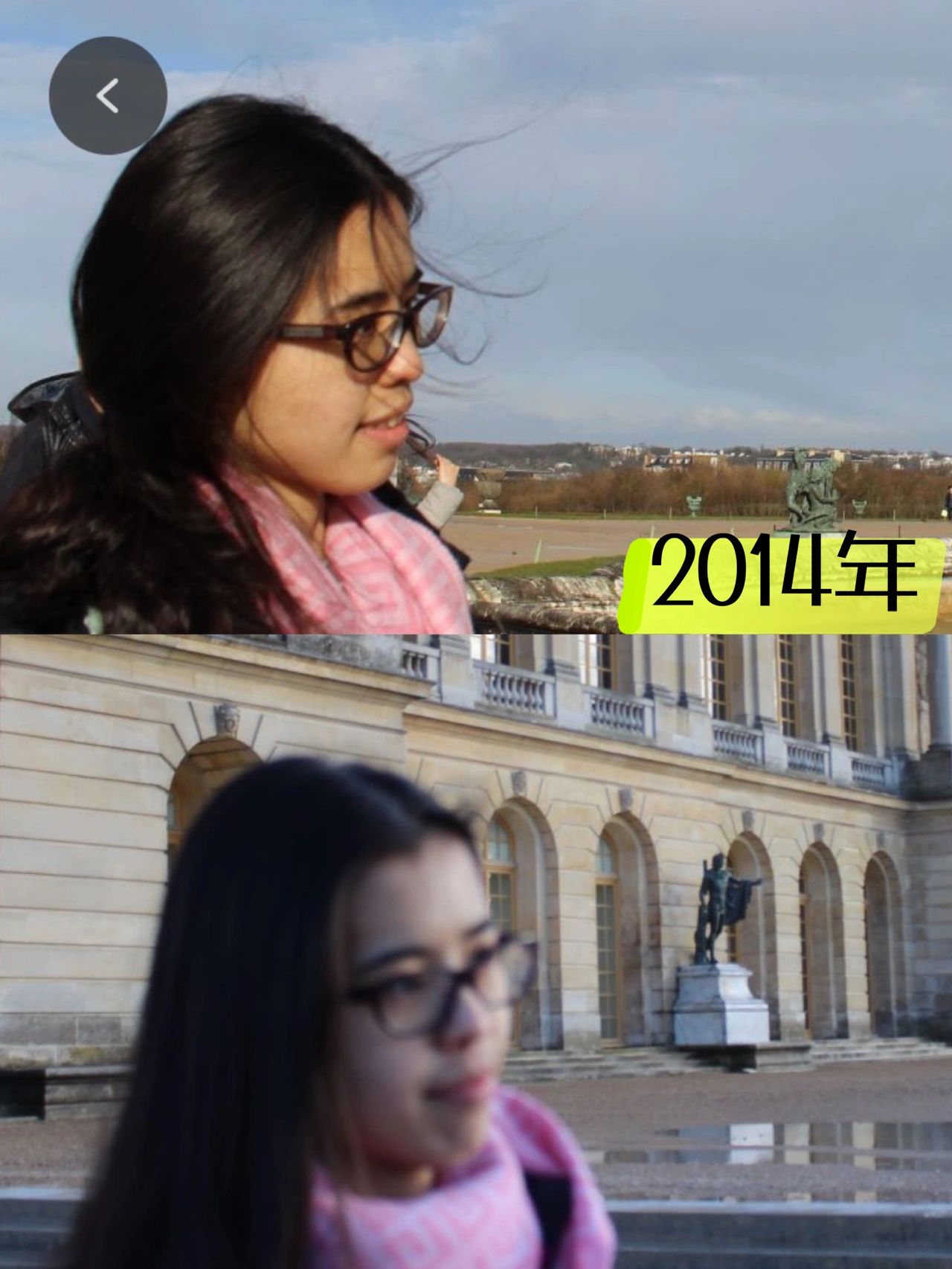 整牙分享,分享自己整牙过程怎么赚钱