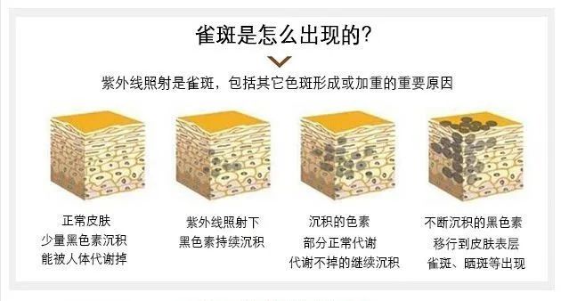 重要|雀斑和*褐斑黄**的注意事项