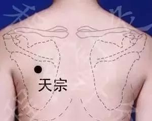 速治颈椎病的秘密原来在这里,揭秘怎么治疗颈椎病看这里