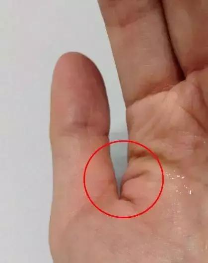 超模消除副乳,超模收副乳