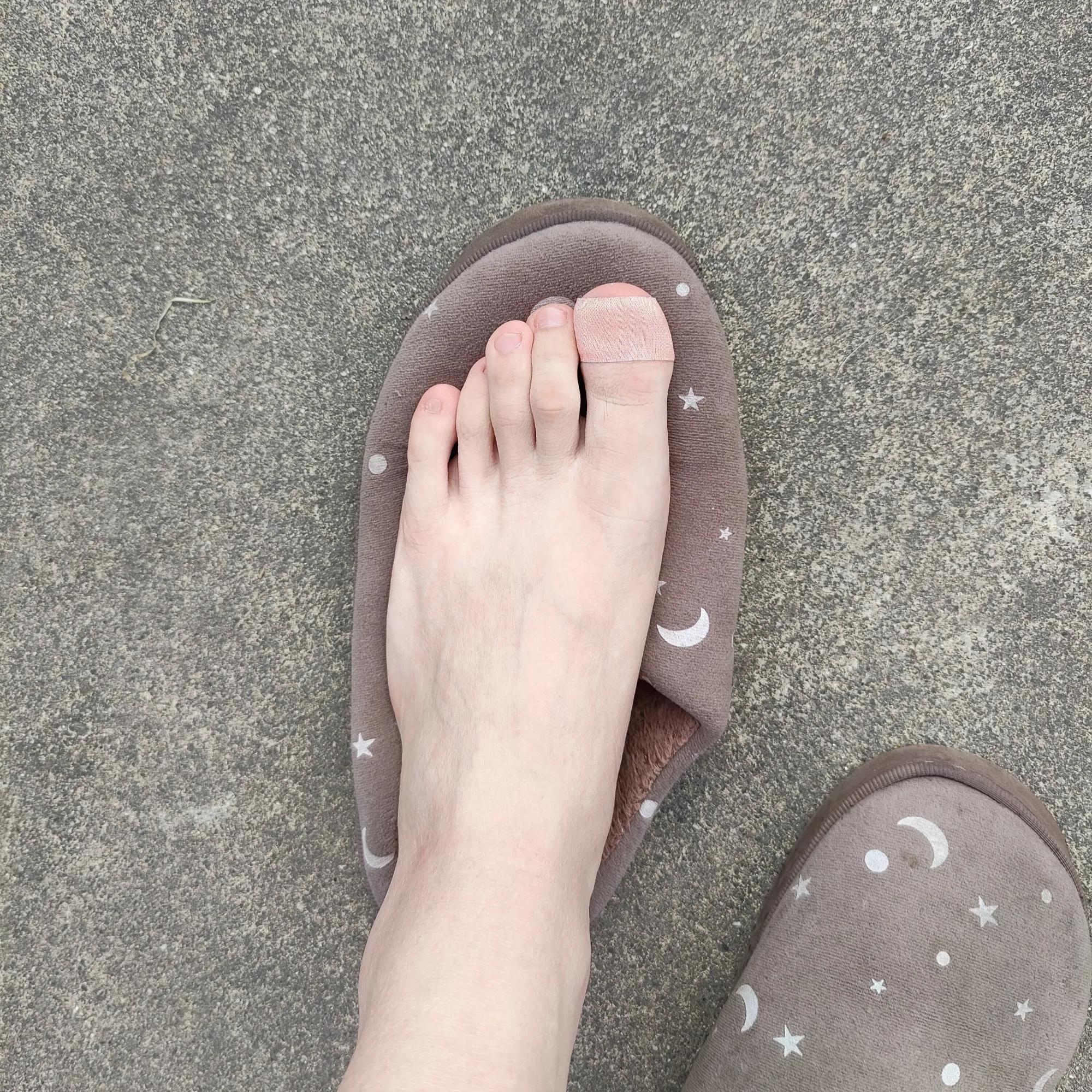 贫民窟的护肤方法,贫民窟护肤小窍门