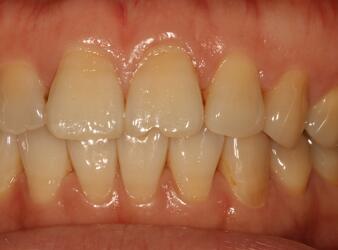 狗狗洗牙的良心忠告,医生忠告千万别洗牙