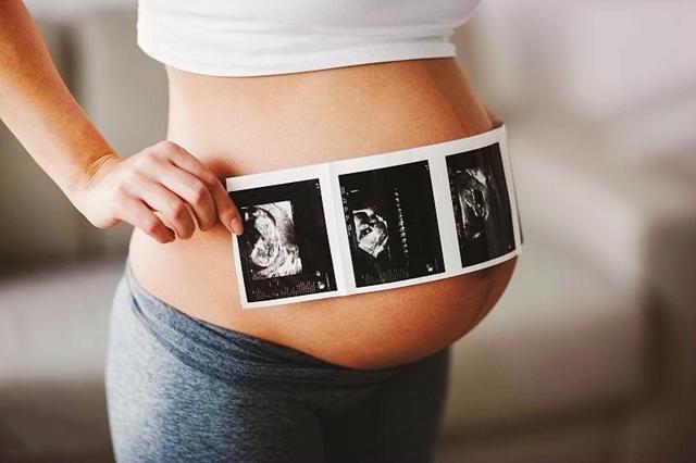 孕妈宫口十指有多大,这三类孕妈不容易长妊娠纹