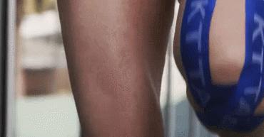 肌内效贴布的应用和原理 (髂胫束综合征怎么使用肌效贴)