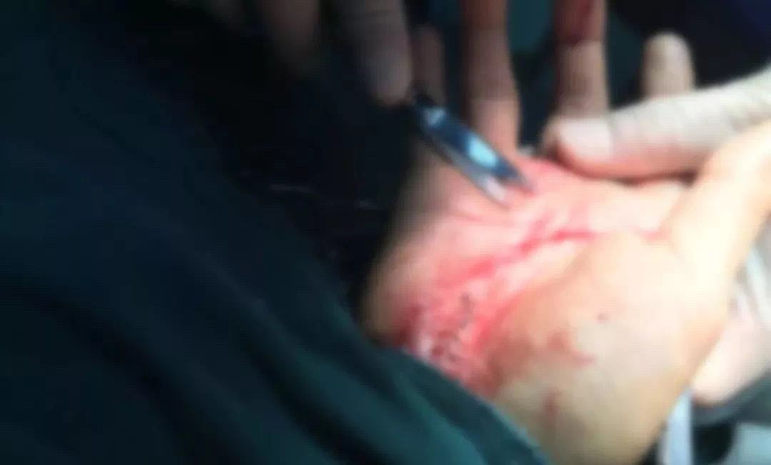 警察抓了吸毒的人要去医院吗,禁毒民警抓捕时疑感染艾滋