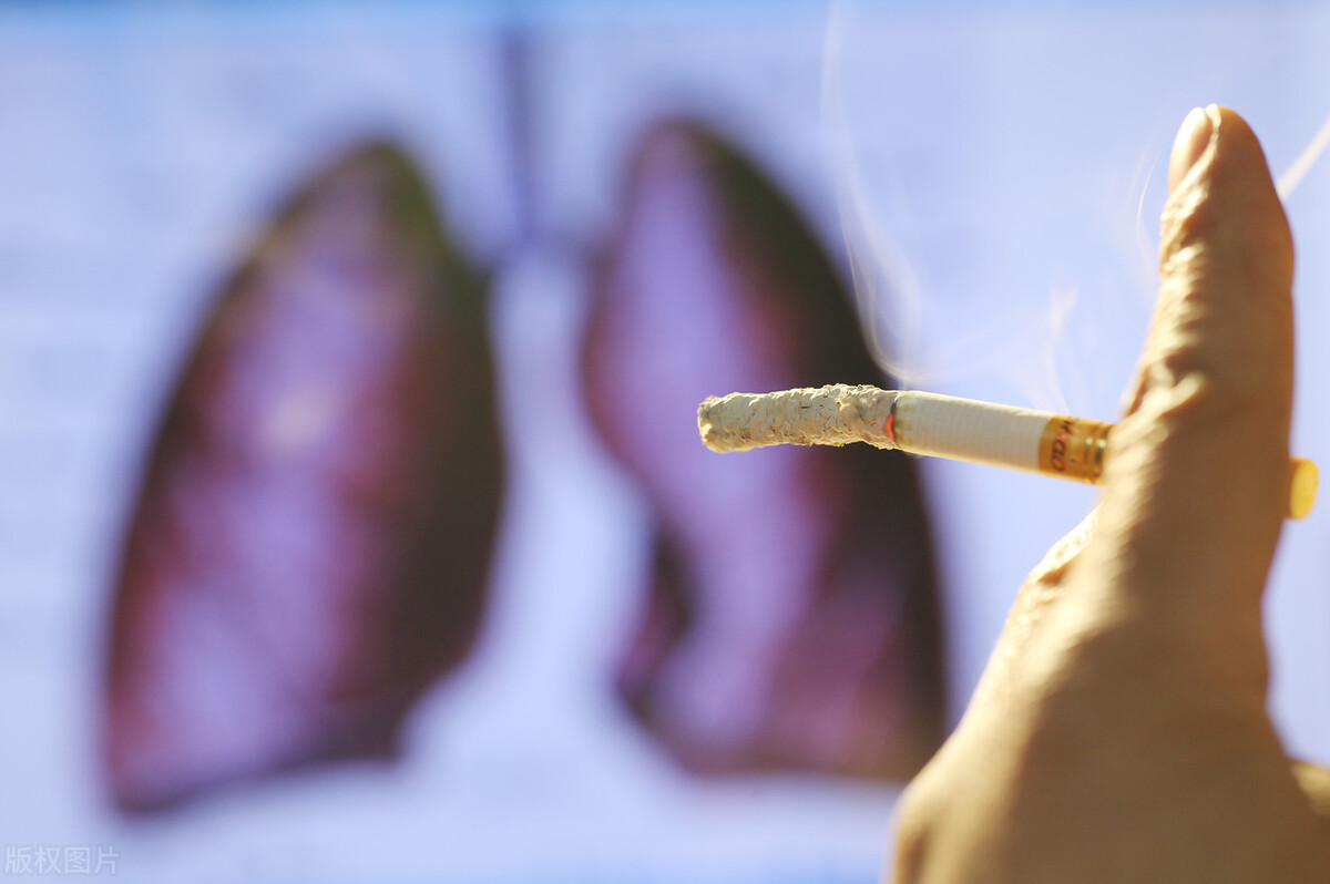 百亿富豪肺癌8年，终究倒下，医生：肺癌术后生存质量，要看这些