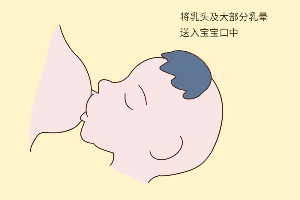 哺乳期乳腺炎堵奶一直反复,乳腺炎堵奶解决方法