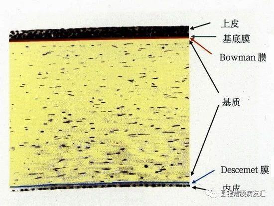 穿透性角膜移植对比板层角膜移植,角膜移植和角膜内皮移植的区别