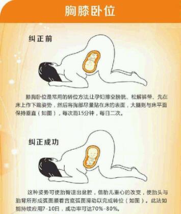 b超单胎位不正,b超单胎位图