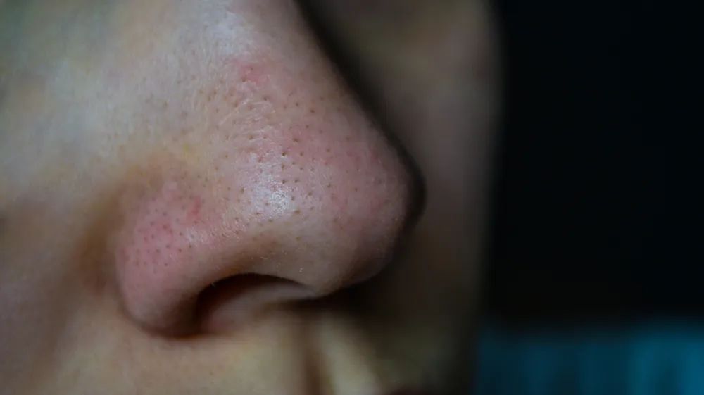 小气泡美容优惠券,小气泡美容护肤团购附近