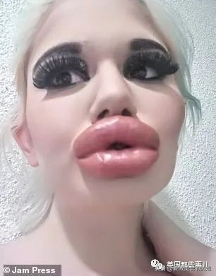 20次整容成功的女人,22岁女人做20次丰唇手术