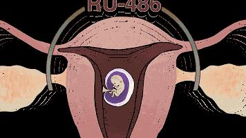 堕胎到底有没有恶果,堕胎真的那么可怕吗