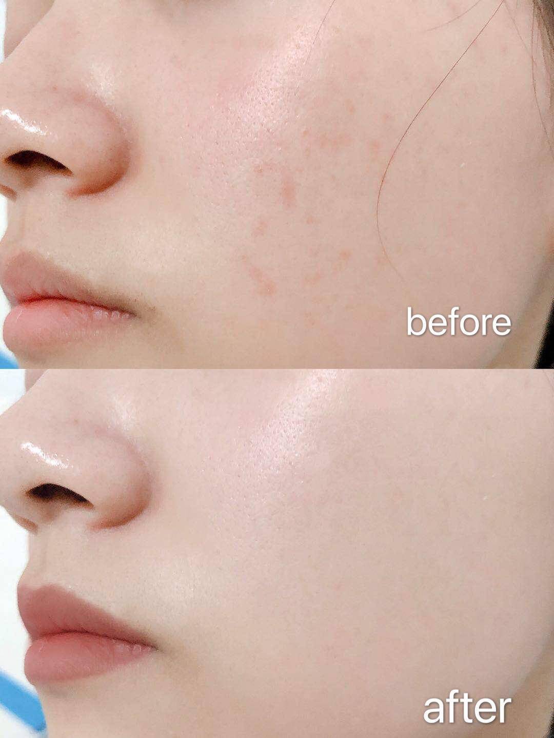 怎么养肤让皮肤细腻又白,如何让皮肤变得嫩白水润好看