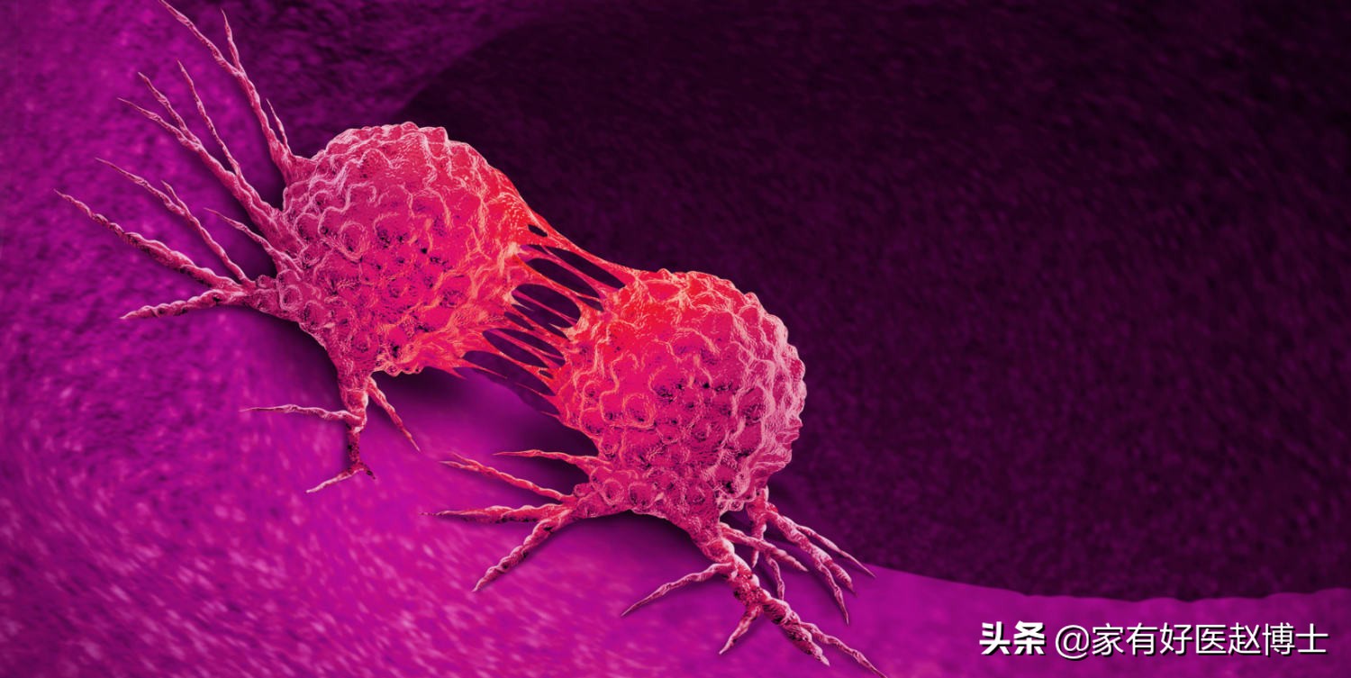 患癌最多的疾病以及预防,四种高致癌性炎症