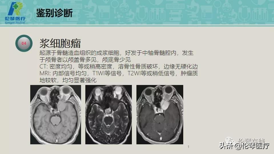 上海教授詹松华,上海曙光医院詹松华简介