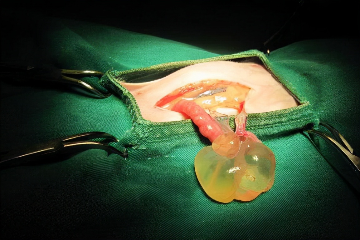 引起结节的三大原因,结节是什么原因造成的怎么治