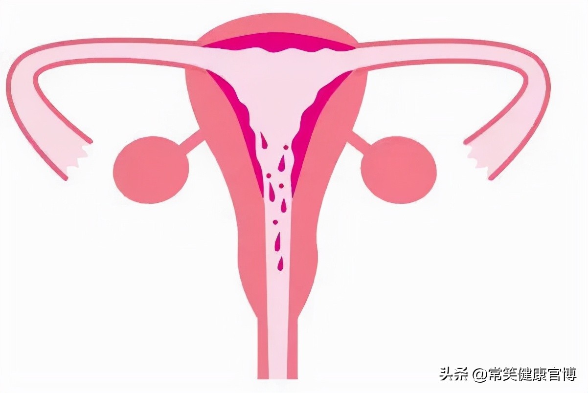 月经为什么会几个月才来,停经一年月经又正常每个月都来