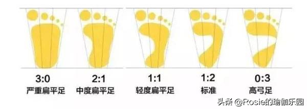 双腿粗最有效方法,腿粗如何凸显脚踝