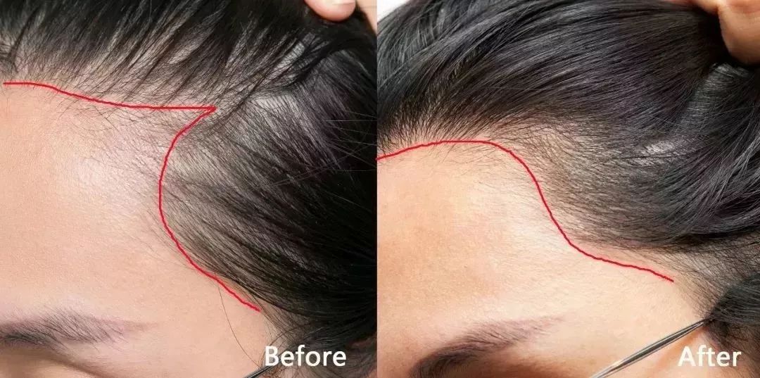 王子文变成儿科医生,王子文变身人形