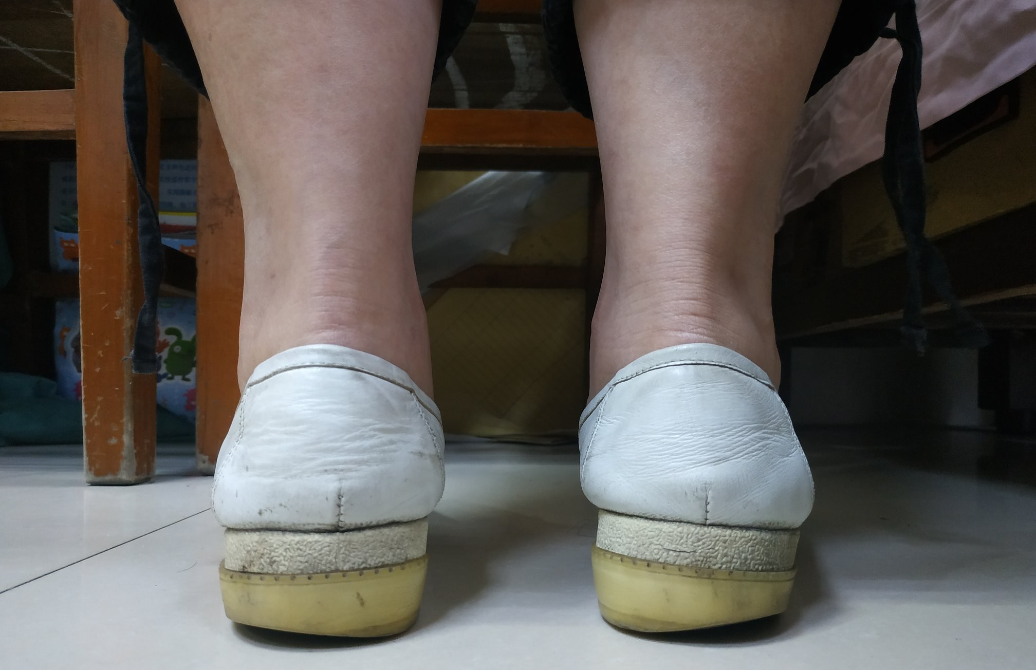 脚上长了茧子怎么回事,如果脚上起硬疙瘩茧子了怎么办