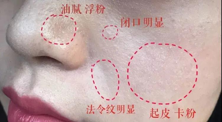 在空调屋里皮肤干燥、瘙痒、泛红，我来帮你解决