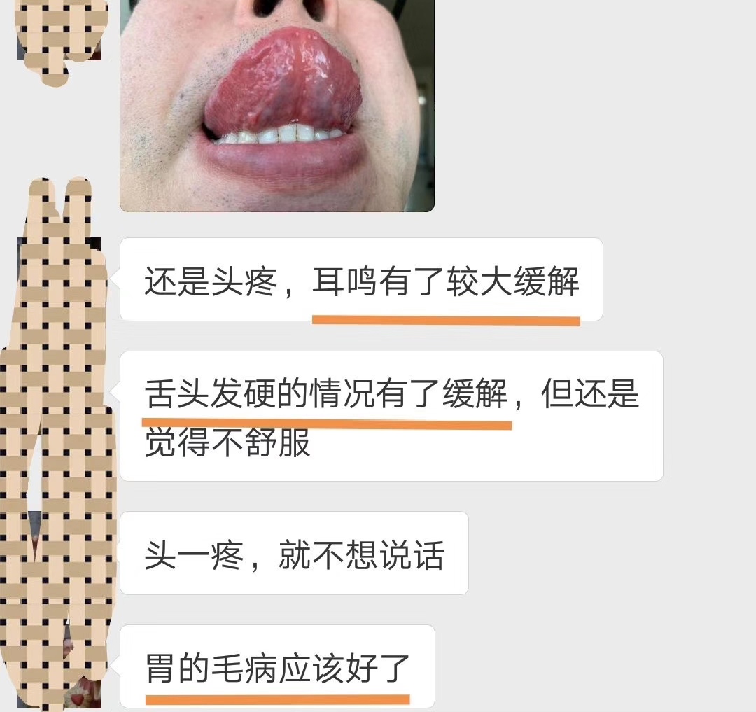 胃食管反流怎么治疗该服用什么药,胃反复发作吃药怎么吃法