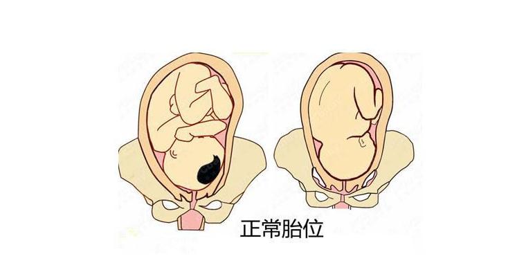 孕妇胎位不正要怎么调整最好,一般孕妇胎位不正怎么纠正效果好