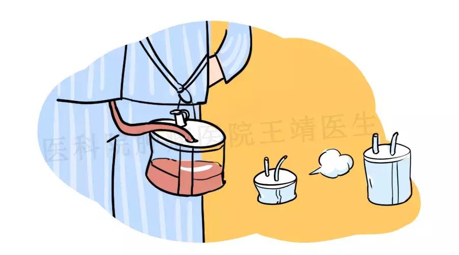 乳腺癌术后引流管什么时候拔最好,乳腺癌引流管液体20ml可以拔吗